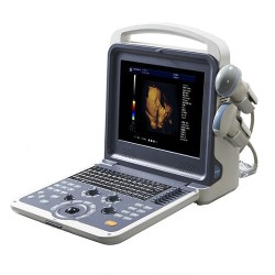Przenośny ultrasonograf z kolorowym dopplerem USG model UMCD01