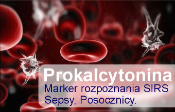 Prokalcytonina_marker_SIRS_sepsa_posocznica